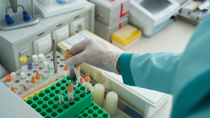 Eli Lilly Pursues $7 Billion Acquisition of Kelonia, Offering $3.25 Billion Upfront